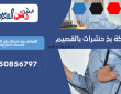 شركة بخ حشرات بالقصيم | 0550856797